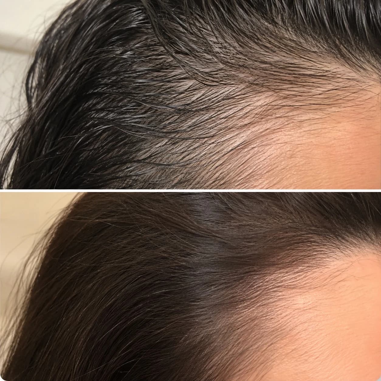 Hairline care routine appearance comparison